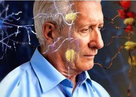 老年痴呆症可以早期预防吗？