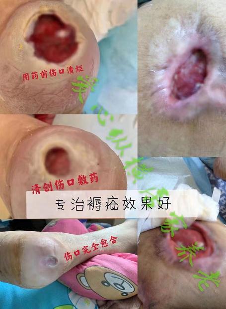 爱心纵横居家养老环境图片